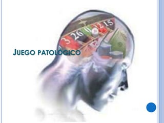 JUEGO PATOLÓGICO
 