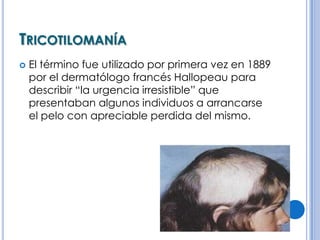 TRICOTILOMANÍA
   El término fue utilizado por primera vez en 1889
    por el dermatólogo francés Hallopeau para
    describir “la urgencia irresistible” que
    presentaban algunos individuos a arrancarse
    el pelo con apreciable perdida del mismo.
 