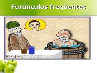 Furúnculos freqüentes

 