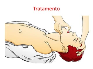 Tratamento
 