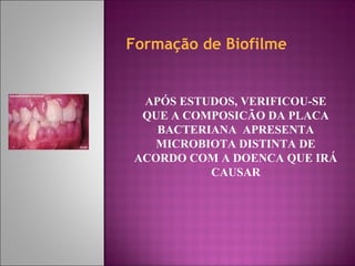 Formação de Biofilme
APÓS ESTUDOS, VERIFICOU-SE
QUE A COMPOSICÃO DA PLACA
BACTERIANA APRESENTA
MICROBIOTA DISTINTA DE
ACORDO COM A DOENCA QUE IRÁ
CAUSAR
 