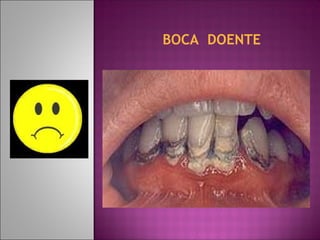 BOCA DOENTE
 