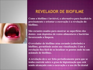 REVELADOR DE BIOFILME
Como o biofilme é invisível, a alternativa para localizá-lo
precisamente e orientar a escovação é a revelação do
biofilme.
São corantes usados para mostrar as superfícies dos
dentes com depósitos de restos alimentares e bactérias
favorecendo a limpeza.
O revelador de biofilme atua corando (colorindo) o
biofilme, permitindo assim sua visualização. Com a
revelação fica fácil de se localizar os pontos onde há um
acúmulo de biofilme.
A revelação deve ser feita periodicamente para que se
tenha controle sobre o grau de higienização que está
sendo alcançado com a escovação e o uso do fio dental
 