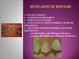 REVELADOR DE BIOFILME
1 - FUCSINA BÁSICA
2 – MARROM DE BISMARCK
3 – IODETO DE POTÁSSIO
4 – SUBSTÂNCIA EVIDENCIADORA À BASE DE
ERITROSINA
5 – SOLUÇÕES EVIDENCIADORAS À BASE DE
ERITROSINA :
azul  biofilme velho  mais de 48 horas.
vermelha  biofilme novo  menos de 48 horas
 