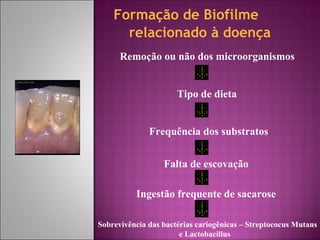 Formação de Biofilme
relacionado à doença
Remoção ou não dos microorganismos
Tipo de dieta
Frequência dos substratos
Falta de escovação
Ingestão frequente de sacarose
Sobrevivência das bactérias cariogênicas – Streptococus Mutans
e Lactobacillus
 
