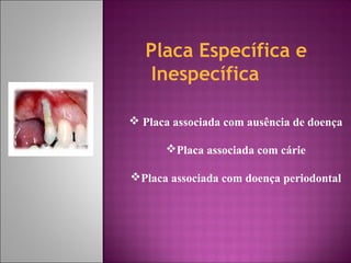 Placa Específica e
Inespecífica
 Placa associada com ausência de doença
Placa associada com cárie
Placa associada com doença periodontal
 