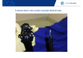 A escova deve ir até a saída na porção distal do tubo .
 