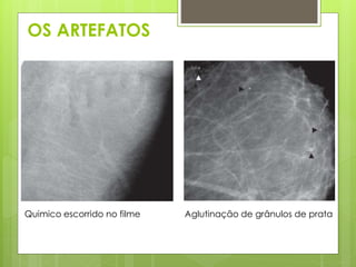 OS ARTEFATOS 
Quimico escorrido no filme Aglutinação de grânulos de prata 
 