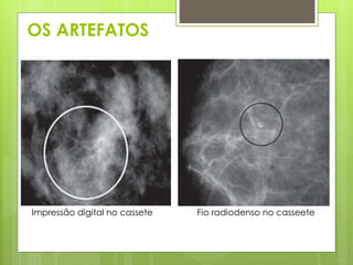 OS ARTEFATOS 
Impressão digital no cassete Fio radiodenso no casseete 
 