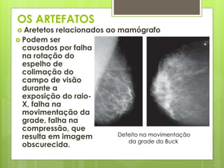 OS ARTEFATOS 
 Aretetos relacionados ao mamógrafo 
Defeito na movimentação 
da grade do Buck 
 Podem ser 
causados por falha 
na rotação do 
espelho de 
colimação do 
campo de visão 
durante a 
exposição do raio- 
X, falha na 
movimentação da 
grade, falha na 
compressão, que 
resulta em imagem 
obscurecida. 
 