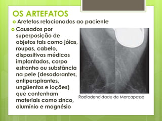 OS ARTEFATOS 
 Aretetos relacionados ao paciente 
Radiodencidade de Marcapasso 
 Causados por 
superposição de 
objetos tais como jóias, 
roupas, cabelo, 
dispositivos médicos 
implantados, corpo 
estranho ou substância 
na pele (desodorantes, 
antiperspirantes, 
ungüentos e loções) 
que contenham 
materiais como zinco, 
alumínio e magnésio 
 