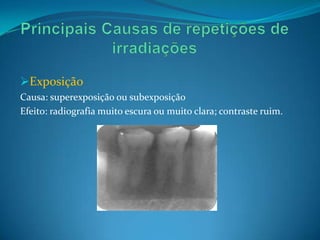 Exposição
Causa: superexposição ou subexposição
Efeito: radiografia muito escura ou muito clara; contraste ruim.
 