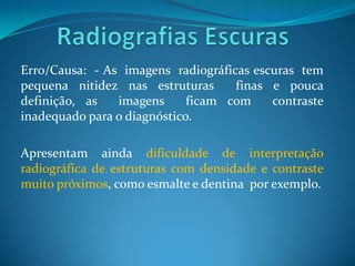 Erro/Causa: - As imagens radiográficas escuras tem
pequena nitidez nas estruturas      finas e pouca
definição, as   imagens      ficam com    contraste
inadequado para o diagnóstico.

Apresentam ainda dificuldade de interpretação
radiográfica de estruturas com densidade e contraste
muito próximos, como esmalte e dentina por exemplo.
 