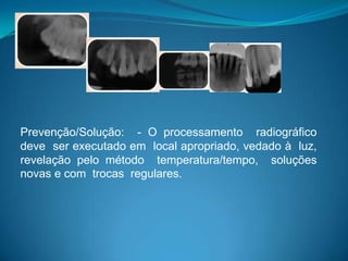 Prevenção/Solução: - O processamento radiográfico
deve ser executado em local apropriado, vedado à luz,
revelação pelo método temperatura/tempo, soluções
novas e com trocas regulares.
 