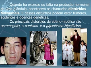 Quando há excesso ou falta na produção hormonal
de uma glândula, acontecem os chamados distúrbios
hormonais. E desses distúrbios podem estar tumores,
acidentes e doenças genéticas.
      Os principais distúrbios da adeno-hipófise são
acromegalia, o nanismo e o gigantismo Hipofisário.
 