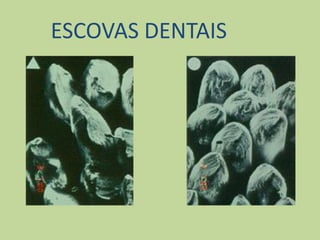 ESCOVAS DENTAIS
 