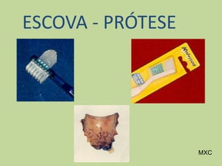 ESCOVA - PRÓTESE
MXC
 