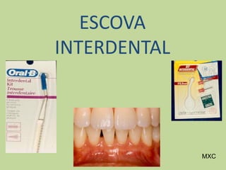 ESCOVA
INTERDENTAL
MXC
 