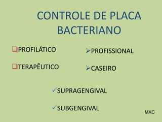 CONTROLE DE PLACA
BACTERIANO
MXC
PROFILÁTICO
TERAPÊUTICO
PROFISSIONAL
CASEIRO
SUPRAGENGIVAL
SUBGENGIVAL
 