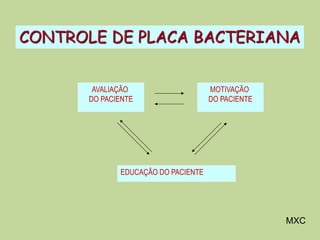 MXC
CONTROLE DE PLACA BACTERIANA
AVALIAÇÃO
DO PACIENTE
MOTIVAÇÃO
DO PACIENTE
EDUCAÇÃO DO PACIENTE
 