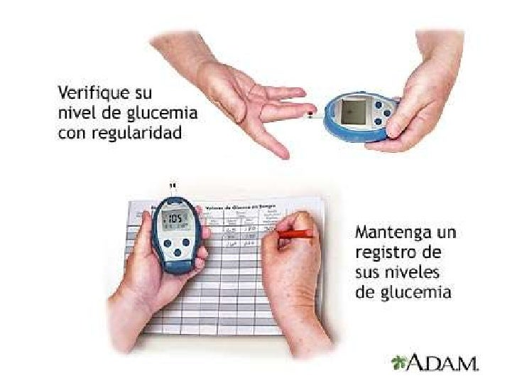 blood glucose a test performing Hormonales Controles Glicemia blood glucose a test performing Hormonales Controles Glicemia