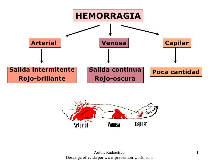 Hemorragia Venosa