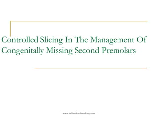 Controlled Slicing In The Management Of
Congenitally Missing Second Premolars
www.indiandentalacademy.com
 