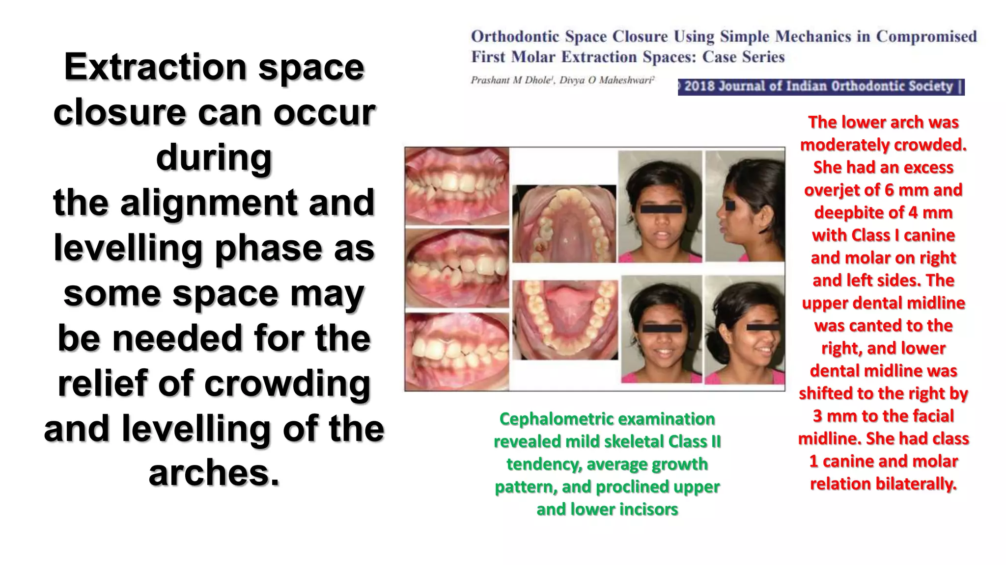 orthodontic controlled space closure | PPTX
