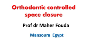 Orthodontic controlled
space closure
Prof dr Maher Fouda
Mansoura Egypt
 