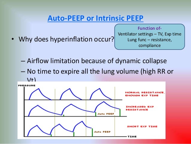 Controlled Collapse - Injection Controlled Collapse - Injection