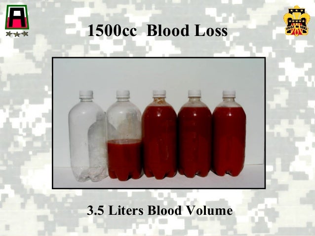Controlling Bleeding controlling-bleeding