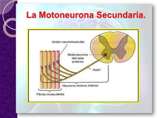 La Motoneurona Secundaria.
 