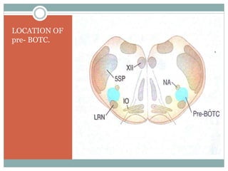 LOCATION OF
pre- BOTC.
 