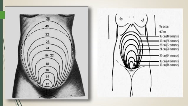 Control prenatal