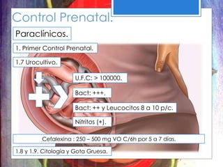 Control Prenatal.
Paraclínicos.
1. Primer Control Prenatal.
1.7 Urocultivo.
U.F.C: > 100000.
Bact: +++.
Bact: ++ y Leucocitos 8 a 10 p/c.
Nitritos (+).
Cefalexina : 250 – 500 mg VO C/6h por 5 a 7 días.
1.8 y 1.9. Citología y Gota Gruesa.
 