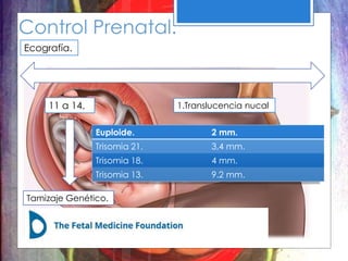 Control Prenatal.
Ecografía.
11 a 14.
Tamizaje Genético.
1.Translucencia nucal
Euploide. 2 mm.
Trisomia 21. 3,4 mm.
Trisomia 18. 4 mm.
Trisomia 13. 9.2 mm.
 
