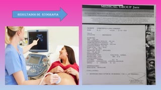 RESULTADOS DE ECOGRAFIA
 