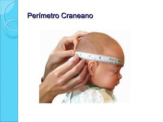 Perímetro CraneanoPerímetro Craneano
 