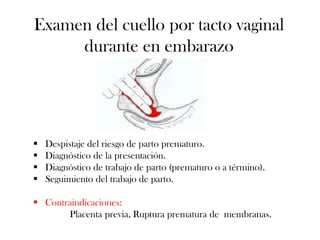 Examen del cuello por tacto vaginal
     durante en embarazo




   Despistaje del riesgo de parto prematuro.
   Diagnóstico de la presentación.
   Diagnóstico de trabajo de parto (prematuro o a término).
   Seguimiento del trabajo de parto.

 Contraindicaciones:
       Placenta previa, Ruptura prematura de membranas.
 