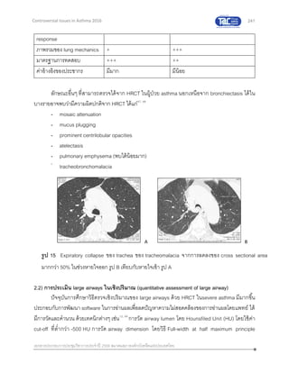 241
เอกสารประกอบการประชุมวิชาการประจาปี 2559 สมาคมสภาองค์กรโรคหืดแห่งประเทศไทย
Controversial Issues in Asthma 2016
response
ภาพรวมของ lung mechanics + +++
มาตรฐานการทดสอบ +++ ++
ค่าอ้างอิงของประชากร มีมาก มีน้อย
ลักษณะอื่นๆ ที่สามารถตรวจได้จาก HRCT ในผู้ป่วย asthma นอกเหนือจาก bronchiectasis ได้ใน
บางรายอาจพบว่ามีความผิดปกติจาก HRCT ได้แก่47, 48
- mosaic attenuation
- mucus plugging
- prominent centrilobular opacities
- atelectasis
- pulmonary emphysema (พบได้น้อยมาก)
-
tracheobronchomalacia
2.2) การประเมิน large airways ในเชิงปริมาณ (quantitative assessment of large airway)
ปัจจุบันการศึกษาวิธีตรวจเชิงปริมาณของ large airways ด้วย HRCT ในsevere asthma มีมากขึ้น
ประกอบกับการพัฒนา software ในการอ่านผลเพื่อลดปัญหาความไม่สอดคล้องของการอ่านผลโดยแพทย์ ได้
มีการวัดและคานวน ด้วยเทคนิกต่างๆ เช่น12, 49
การวัด airway lumen โดย Hounsfiled Unit (HU) โดยใช้ค่า
cut-off ที่ต่ากว่า -500 HU การวัด airway dimension โดยวิธี Full-width at half maximum principle
A B
รูป 15 Expiratory collapse ของ trachea ของ tracheomalacia จากการลดลงของ cross sectional area
มากกว่า 50% ในช่วงหายใจออก รูป B เทียบกับหายใจเข้า รูป A
 
