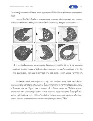 243
เอกสารประกอบการประชุมวิชาการประจาปี 2559 สมาคมสภาองค์กรโรคหืดแห่งประเทศไทย
Controversial Issues in Asthma 2016
นามารักษาผู้ป่วย asthma ที่มี small airway dysfunction นั้นได้ผลดีกว่าการใช้ inhaled corticosteroid
ทั่วไป51
นอกจากนี้อาจได้ประโยชน์จาก oral leukotriene modifiers เช่น montelukast และ systemic
corticosteroid ที่ได้ผลในแง่ของ systemic effect ที่เข้าถึง small airways ของผู้ป่วย severe asthma ได้52
การตรวจทางห้องปฏิบัติการอื่นๆ
การวัดระดับ serum immunoglobulin E (IgE) และ complete blood count และนับจานวน
eosinophils ระดับ IgE ในผู้ป่วย difficult asthma นั้นอาจช่วยในการวินิจฉัยABPA โดยที่ผู้ป่วย ABPA จะพบ
ระดับ serum total IgE ที่สูงกว่า 1000 IU/mlนอกจากนี้ระดับ total serum IgE ใช้ปรับขนาดของยา
omalizumab รักษา severe allergic asthma สาหรับ peripheral blood eosinophilia นั้นอาจสูงขึ้นได้ใน
asthma กรณีที่ระดับสูงมากกว่า 1500/mm3
ต้องคิดถึงภาวะ hyper-eosinophilic syndrome หรือ Churg
Strauss Vasculitis (Eosinophilic Granulomatosis with polyangiitis: EGPA) ไว้ด้วย53
A B C
D E F
รูป 17 การประเมิน extension ของ air trapping ใน asthma จาก HRCT อาศัย การวัด low attenuation
area (LAA) ในระดับความรุนแรงต่างๆ โดยประเมินจาก extension ของ LAA กับ area ทั้งหมด รูป A = 0%,
รูป B น้อยกว่า 25%, รูป C และ D ระหว่าง 25-50%, รูป E ระหว่าง 50-75% และ รูป F มากกว่า 75%
ตามลาดับ
 