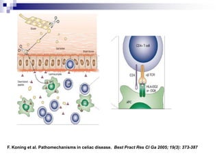 F. Koning et al. Pathomechanisms in celiac disease. Best Pract Res Cl Ga 2005; 19(3): 373-387
 