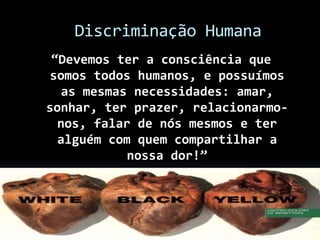 Discriminação Humana
“Devemos ter a consciência que
somos todos humanos, e possuímos
as mesmas necessidades: amar,
sonhar, ter prazer, relacionarmo-
nos, falar de nós mesmos e ter
alguém com quem compartilhar a
nossa dor!”
 