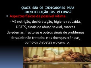 QUAIS SÃO OS INDICADORES PARA
IDENTIFICAÇÃO DAS VÍTIMAS?
 Aspectos físicos da possível vítima:
-Má nutrição, desidratação, higiene reduzida,
DST´S, sinais de abuso sexual, marcas
de edemas, fracturas e outros sinais de problemas
de saúde não tratados e as doenças crónicas,
como os diabetes e o cancro.
 