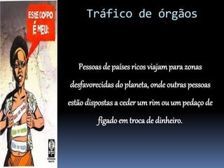 Tráfico de órgãos
Pessoas de países ricos viajampara zonas
desfavorecidas do planeta, onde outras pessoas
estão dispostas a ceder um rimou um pedaço de
fígado em troca de dinheiro.
 