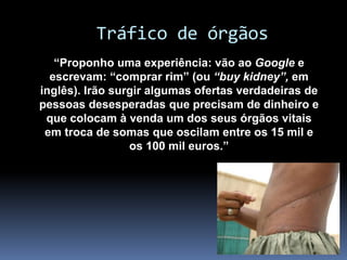 Tráfico de órgãos
“Proponho uma experiência: vão ao Google e
escrevam: “comprar rim” (ou “buy kidney”, em
inglês). Irão surgir algumas ofertas verdadeiras de
pessoas desesperadas que precisam de dinheiro e
que colocam à venda um dos seus órgãos vitais
em troca de somas que oscilam entre os 15 mil e
os 100 mil euros.”
 