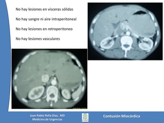 EKG 1Contusión MiocárdicaJuan Pablo Peña Diaz,  MDMedicina de Urgencias