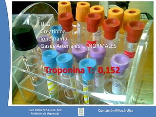 Contusión MiocárdicaJuan Pablo Peña Diaz,  MDMedicina de Urgencias