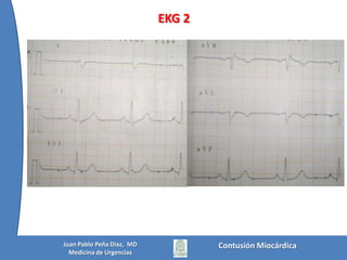 Contusión MiocárdicaJuan Pablo Peña Diaz,  MDMedicina de Urgencias