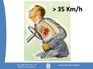 Contusión MiocárdicaJuan Pablo Peña Diaz,  MDMedicina de Urgencias